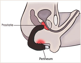 Querschnitt Anatomie Mann - Prostata