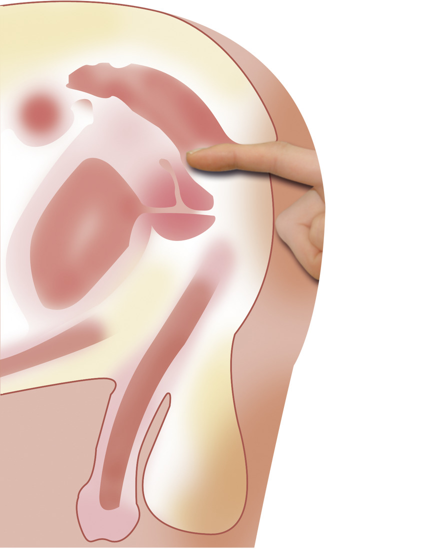Prostata Massage mit Finger