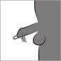 Urethral Stretcher 