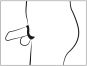 Penis Käfig mit herausnehmbarem Dilator 