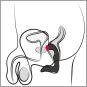Rebel Prostate Plug Recharge 